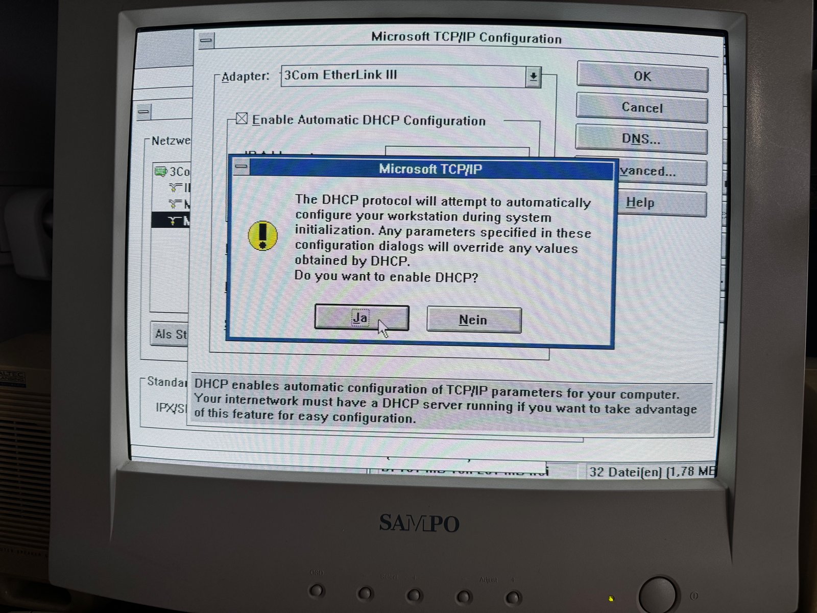 Enabling DHCP in the Microsoft TCP/IP configuration Enabling DHCP in the Microsoft TCP/IP configuration